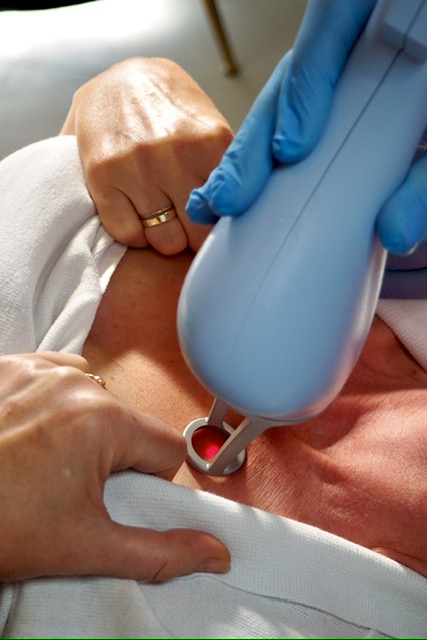 Mezoterapia próżniowa – Anna Stelmach Clinic
